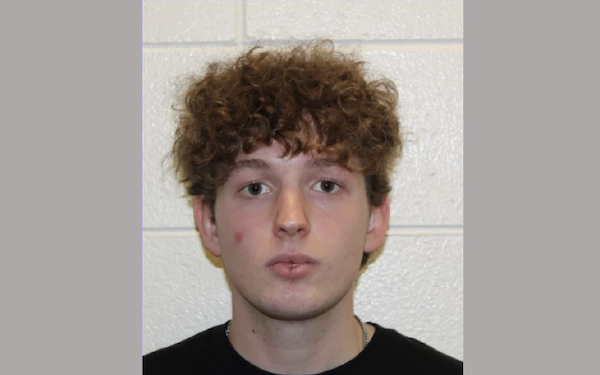 Portrait of a young adult male with fair skin and visible blemishes on his face, posing against a textured white background.